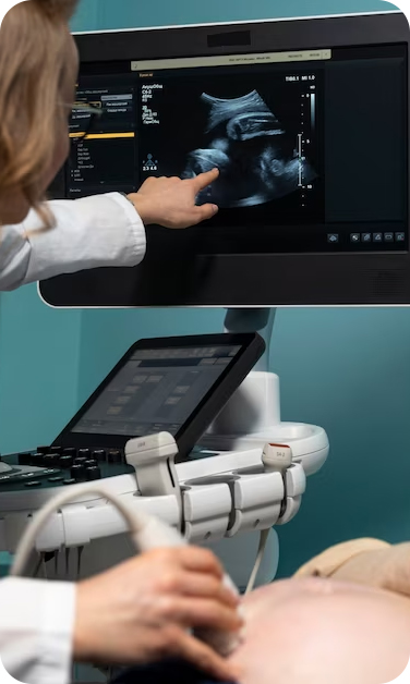 FertLife Clinic - Ultrassonografias seriadas para controle de ovulação