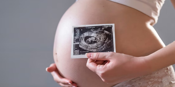 FertLife Clinic - Monitorização da Ovulação